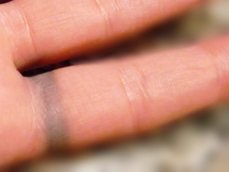 Why Some Jewelry Turns Your Skin Green? | Jewelry Jealousy